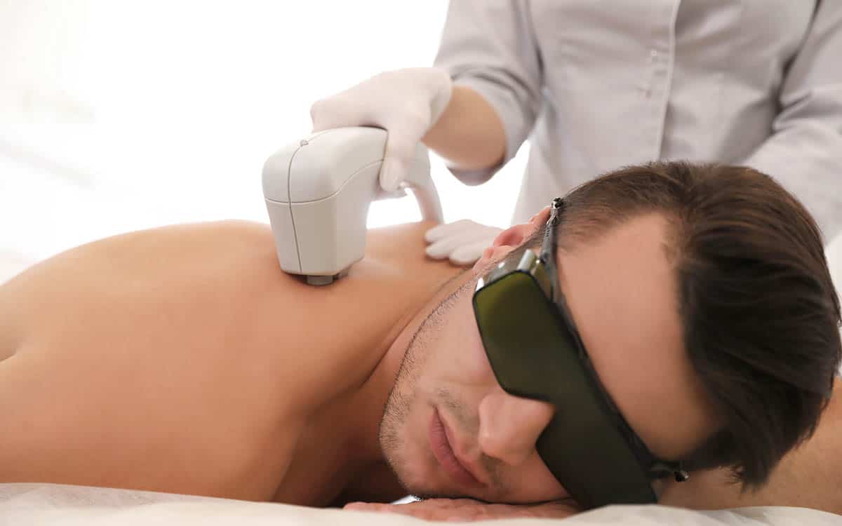epilazione-laser-efficace-trattamento-uomo