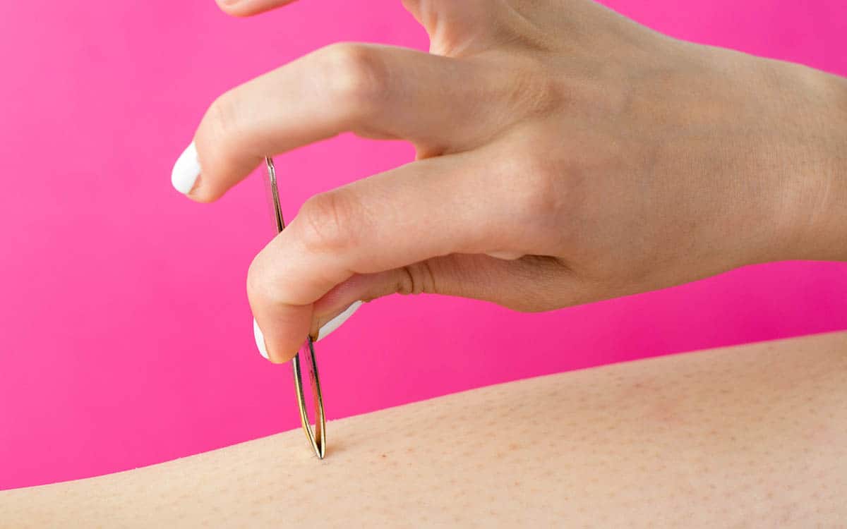 aumentare-efficacia-laser-pinzetta
